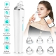 5MP Intelligent Visible Blackhead Cleaner