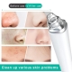 5MP Intelligent Visible Blackhead Cleaner