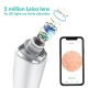 5MP Intelligent Visible Blackhead Cleaner