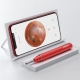 Luxurious Intelligent Ear Wax Removal Tool